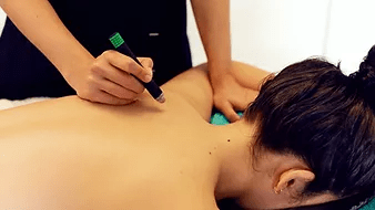 Représentation de Moxibustion